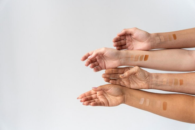 Vitiligo type