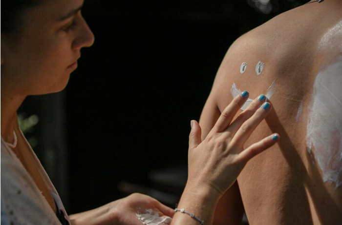 Vitiligo cream