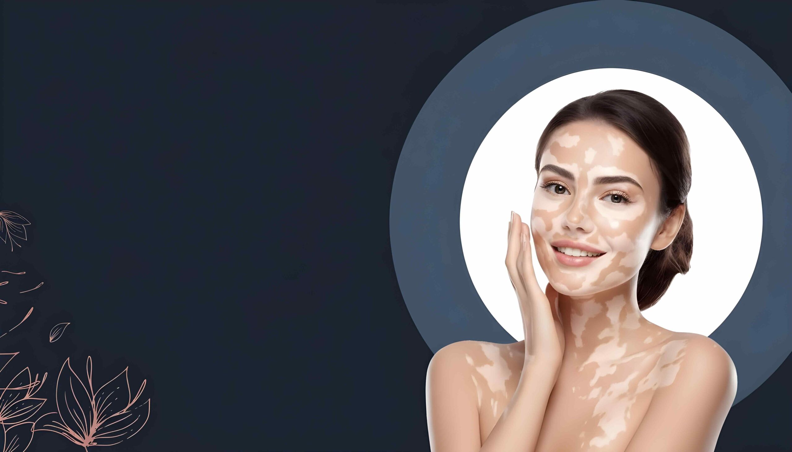 Laxmi Vitiligo Centre Banner Image of women with vitiligo.