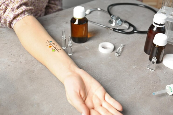 vitiligo-treatment