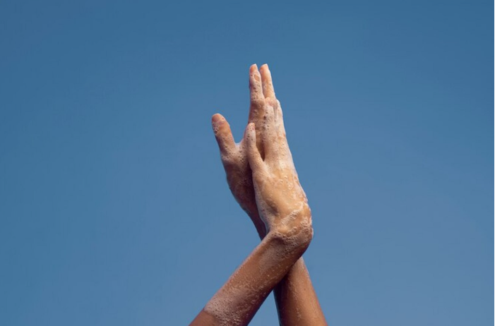 vitiligo hand