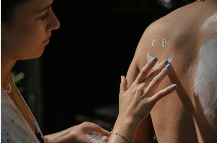 Vitiligo cream