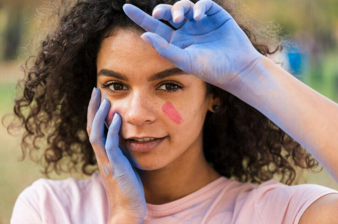 vitiligo