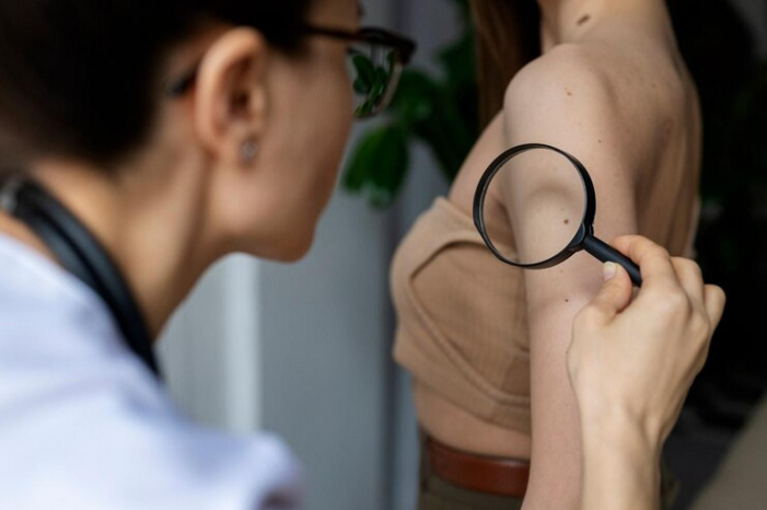 Vitiligo therapy